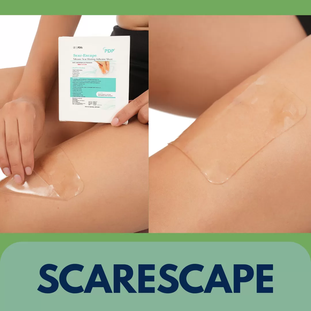 SILICONE SCAR  HEALING SHEET (MEDICAL)